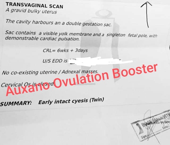 Twin pregnancy scan